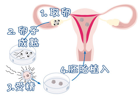 周顾问